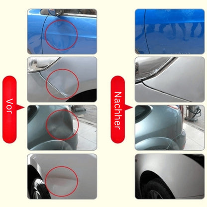 AutoDentPro™ | Herramienta para desabollar | Elimina abolladuras y golpes del coche